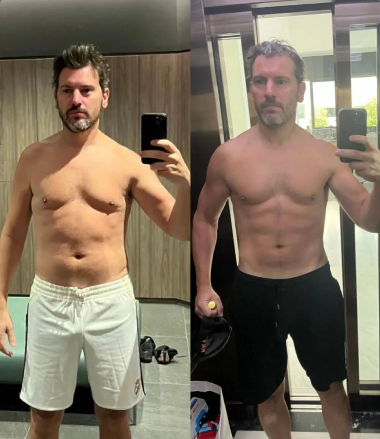 Philippe, Avant, après, 6 mois